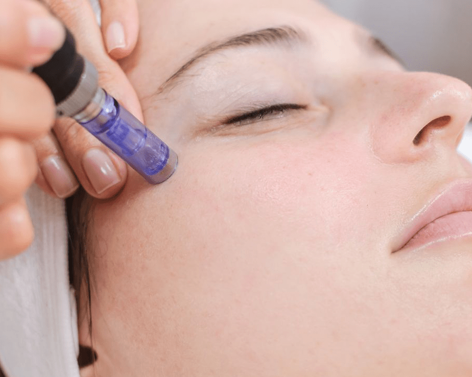 Read more about the article Why Microneedling?
