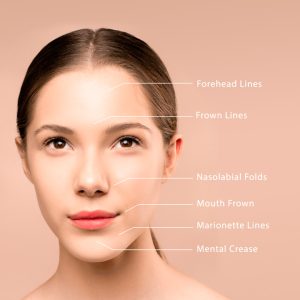Where fillers can be injected ?