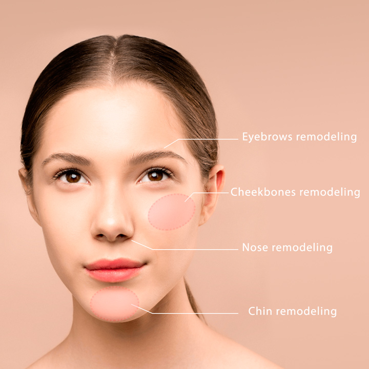 Face remodeling with filler injections