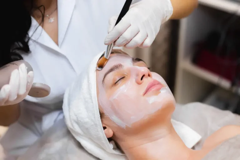 Read more about the article What Can Chemical Peels Do for Your Skin?